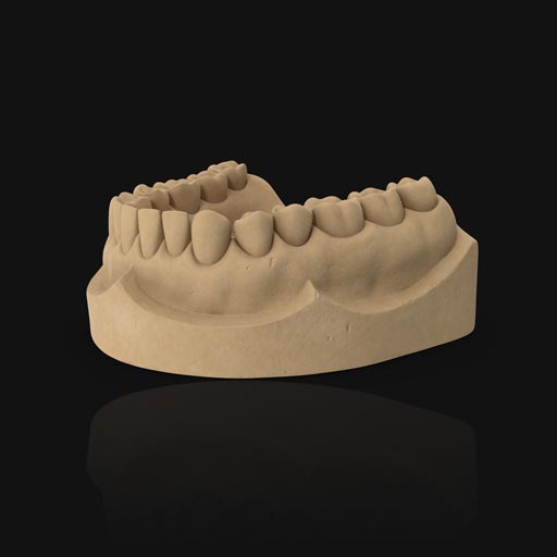 Dental model from 3D printer